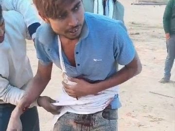 बदायूं में युवक पर चाकू से जानलेवा हमला; घायल जिला अस्पताल में भर्ती, हमलावरों की तलाश जारी