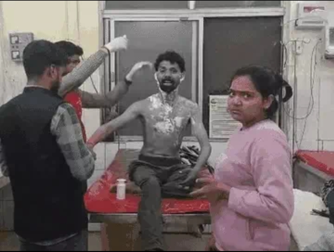 छह साल बाद उतरा लव मैरिज का भूत; बोला- पत्नी कहती है नीले ड्रम में भरवा दूंगी, जूते से मारती है, पति ने आग लगाई