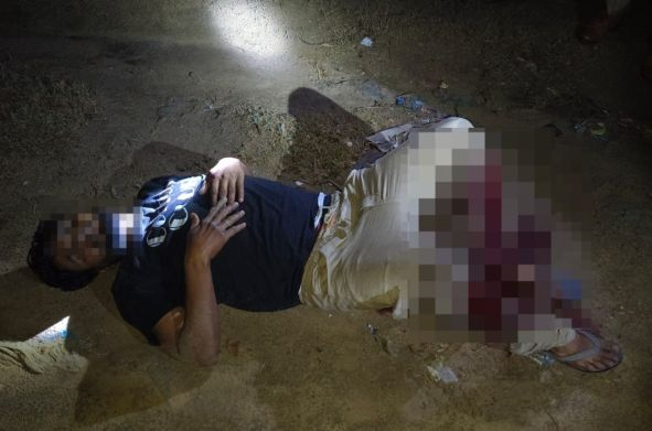 बदायूं में पुलिस मुठभेड़; महिला से कुंडल लूटने वाला बदमाश गिरफ्तार, सिपाही भी घायल