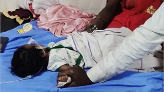 डॉक्टर भी हो गए हैरान ! 3 महीने के मासूम के पेट से निकला ‘जुड़वां बच्चा’, दुनिया में ऐसे मिले हैं 300 केस