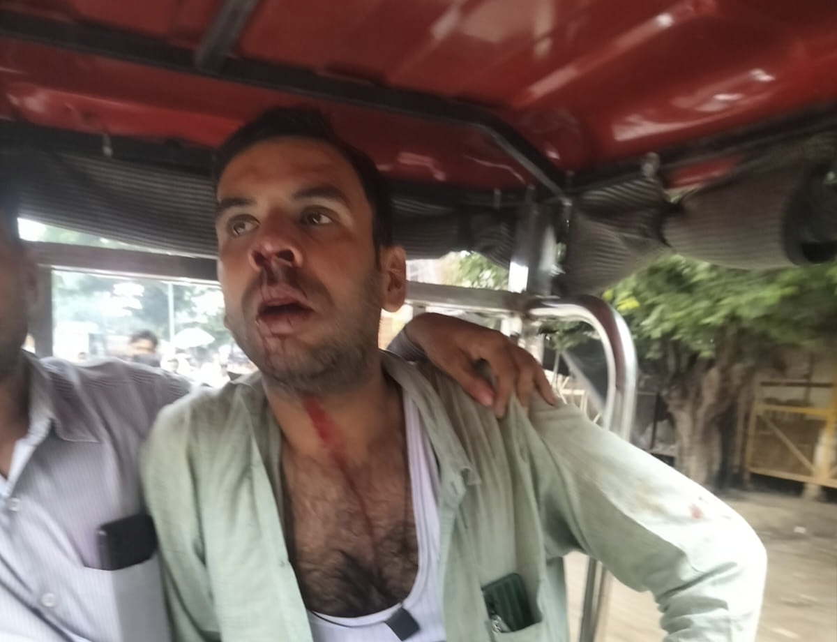 बिसौली में पुरानी रंजिश के चलते हमलावरों ने युवक को घेरकर पीटा, जिला अस्पताल में भर्ती
